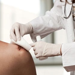 Debridement and Dressing