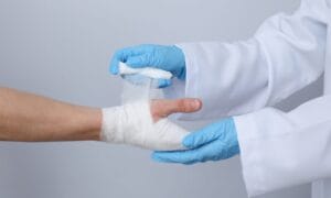 Chronic Wound